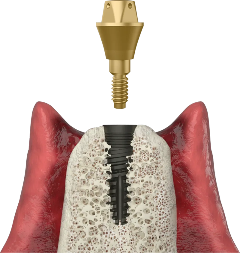 Install the i-base